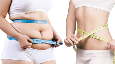 Proven methods of aesthetic medicine for effective weight loss