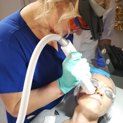 Reduction of vascular changes using the V-Laser device at the Dr Parda Aesthetic Medicine Clinic