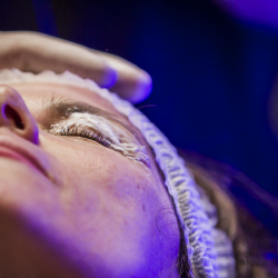 PLASMAGE - upper eyelid lifting treatment at the Dr. Parda Aesthetic Medicine Clinic